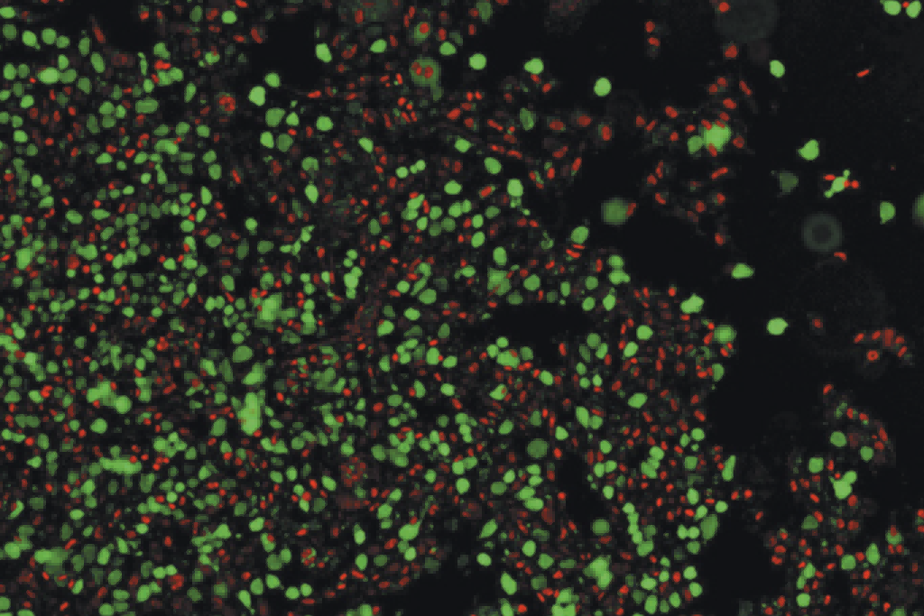 每天在做的转染，还能有什么新意？