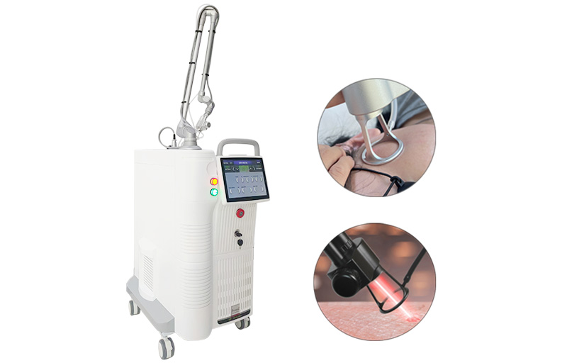Skin Resurfacing Melasma Therapy Fractional CO2 Laser Stretch Mark Removal Machine