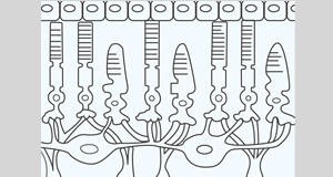 ○ 视网膜因素——等像矫正时,需要结合视网膜因素进行光学设计