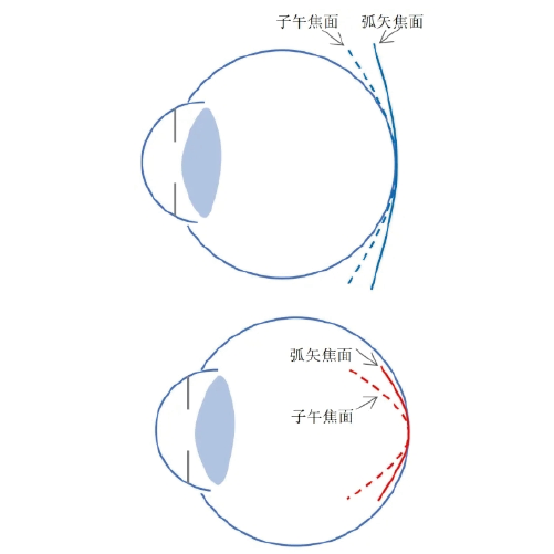 人眼成像的周边离焦与像散系数