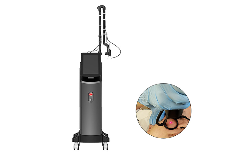 New Skin Glowing Pigments Melasma Removal Laser Fractional CO2 Laser machine